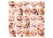 Diş Hekimliğinde Gülüş Tasarımı